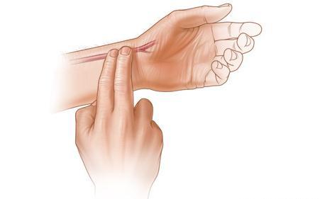 的桡动脉(在大拇指这一端的手腕处)上,测定完整的一分钟以内的脉搏